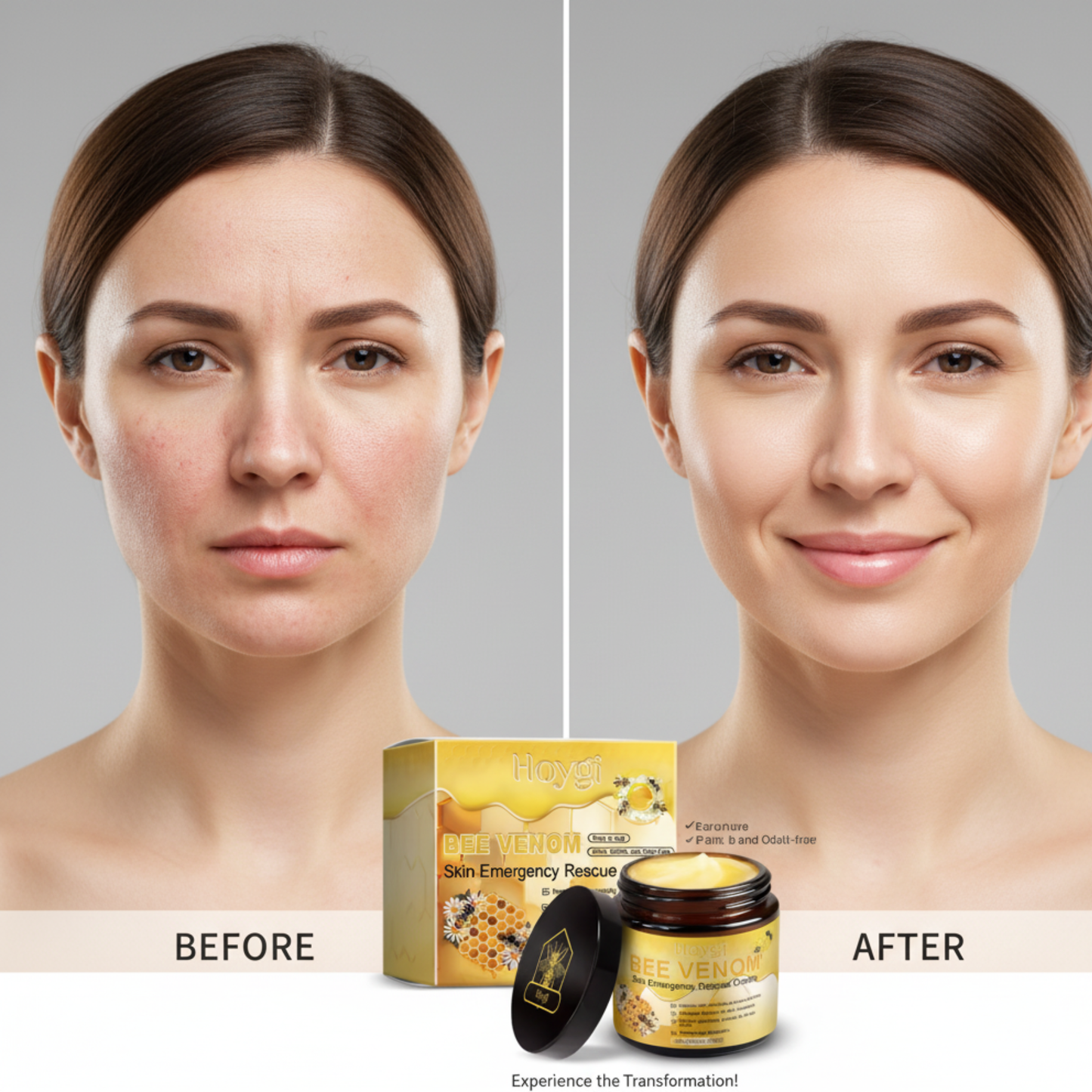 HOYGI Bee Venom Repair Cream – Deep Moisturizing & Redness Relief Skin Barrier Strengthening Cream (60g)